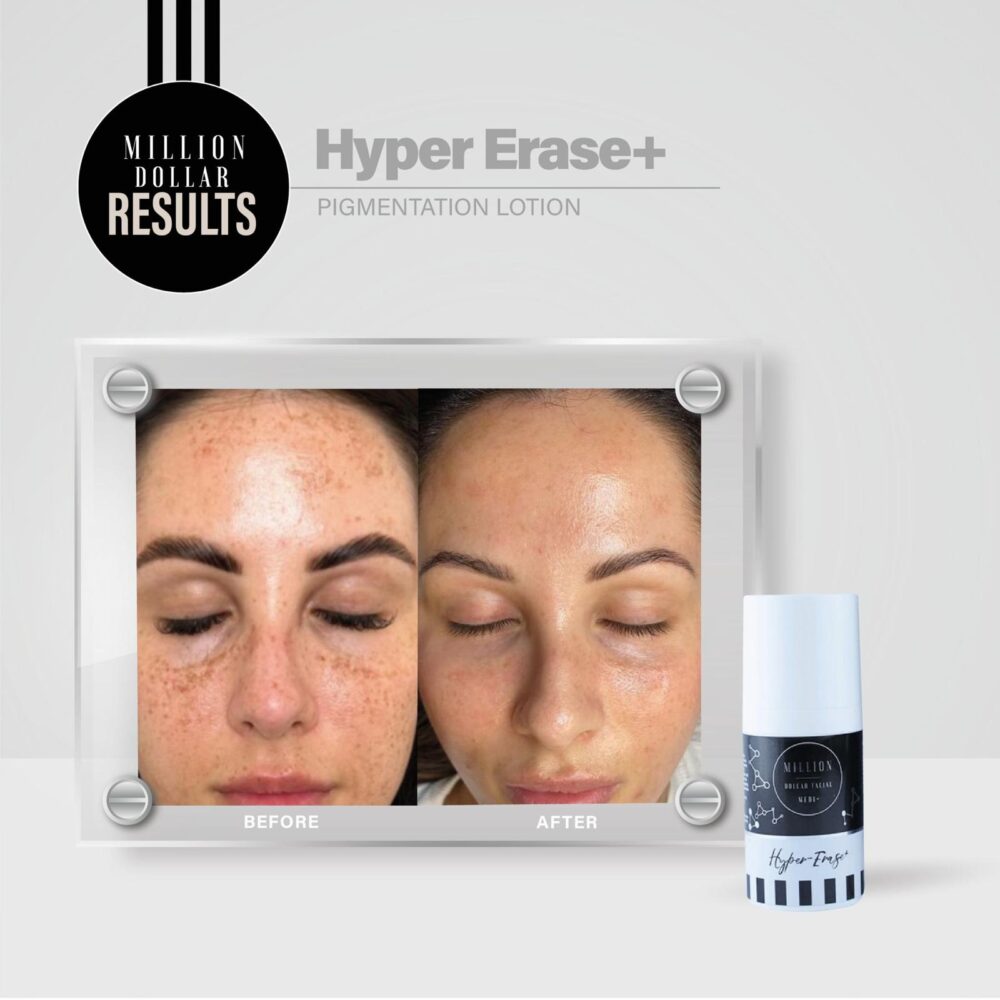 Medi+ Hyper Erase+ – 30ml